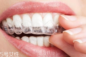 带了隐形牙套可以用电动牙刷吗,隐形牙套可以只带上面吗 带了隐形牙套可以用电动牙刷吗,隐形牙套可以只带上面吗