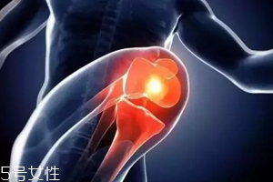 关节有声响是什么原因,关节发生响声