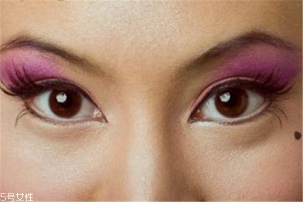 黑痣是怎么形成的?,脸上的黑痣是怎么形成的