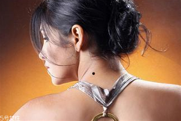脖子后面有个黑色的痣,脖子后面有黑痣代表什么意思