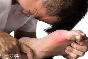 痛风可以治愈吗?,痛风能彻底治愈吗