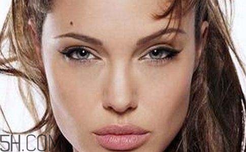 什么情况下容易长斑,为什么容易长斑