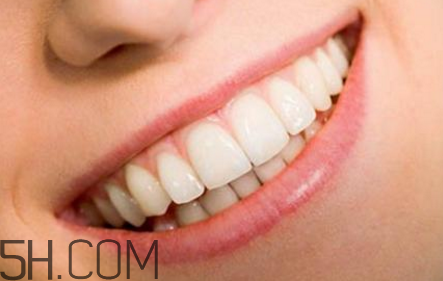 做个牙贴面需要多少费用,贴牙片多少钱