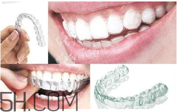 牙套的作用是什么?,牙套起什么作用