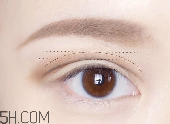 双眼皮手术后饮食方面应该注意哪些,双眼皮术后饮食注意事项有哪些 双眼皮手术后饮食方面应该注意哪些,双眼皮术后饮食注意事项有哪些