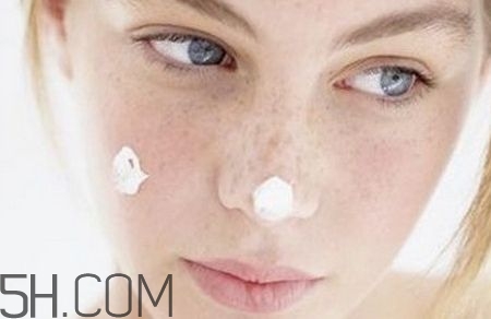 色斑的类型,色斑分为哪些类型