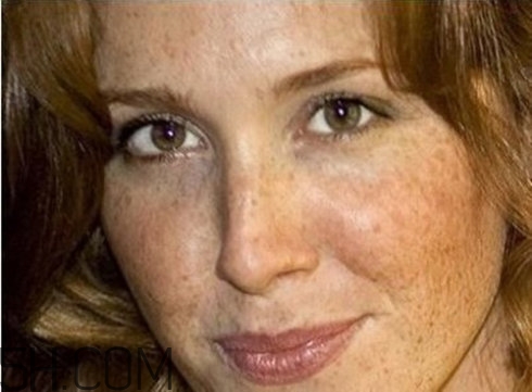 血瘀会长斑吗,什么体质容易长斑