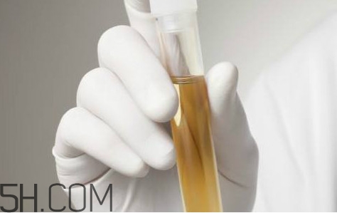 得了尿毒症用什么药治的好,尿毒症有什么治疗方法