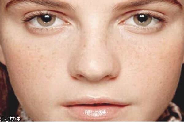 大蒜能祛斑吗,大蒜擦脸真的能祛斑吗