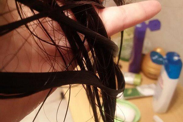 冬天掉发多正常吗,4天不洗头掉发多正常吗