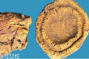 大黄是凉性的吗,大黄是凉性的吗体寒能吃大黄吗