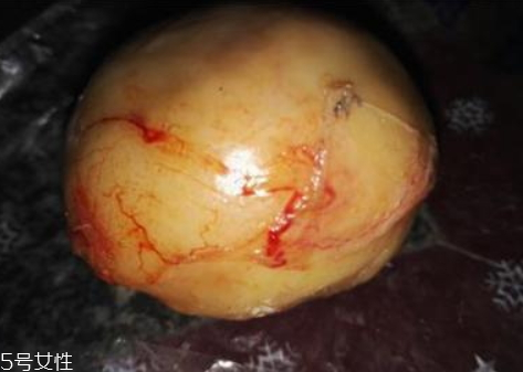 鸭宝怎么形成的,什么是鸭宝 鸭宝怎么形成的,什么是鸭宝