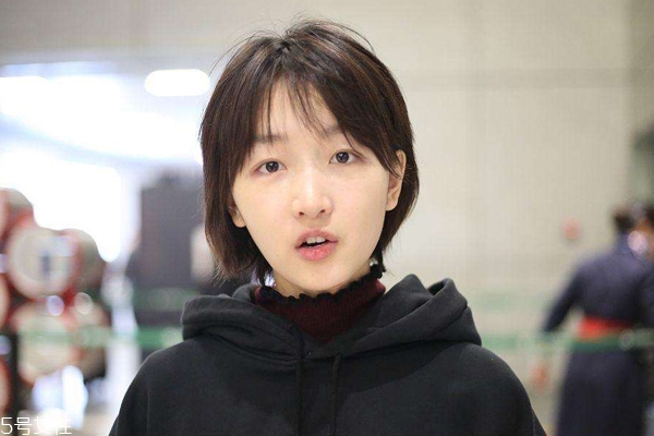 肿泡眼的症状,什么是肿泡眼