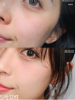 掉头发和不吃饭有关系吗(掉头发和不吃饭有关系吗)