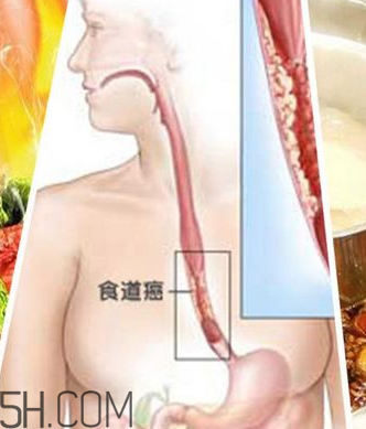 吃太烫会得癌吗,吃的太烫会致癌吗