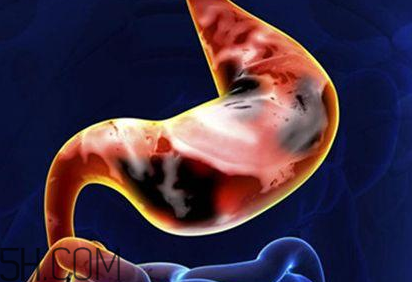 太烫的食物对胃有什么伤害,经常吃烫食物会致癌吗