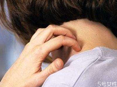 荨麻疹如何防止复发(如何防止荨麻疹反复发作)