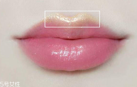 痘痘粉刺怎么预防(怎么预防长痘痘粉刺)