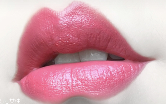 什么情况下脸上长痘痘要用酒精消毒(脸上长痘痘用酒精消毒可以吗)