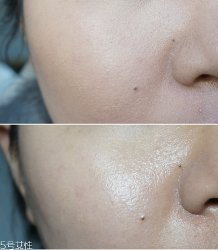 固态面膜的特色(固体面膜好不好) 固态面膜的特色(固体面膜好不好)