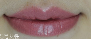 耳洞为什么会发臭(耳朵上一个洞老流臭水,怎么办) 耳洞为什么会发臭(耳朵上一个洞老流臭水,怎么办)