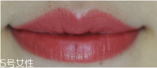 痘痘有几种(痘痘有几种类型) 痘痘有几种(痘痘有几种类型)