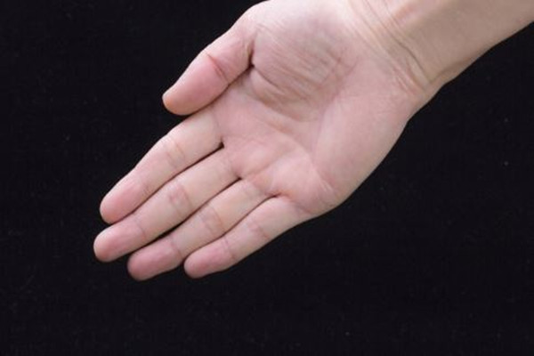 手汗症有遗传性吗(手汗症有遗传性吗)