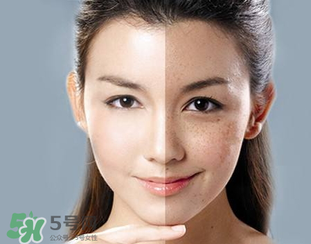 柿子叶能祛斑吗,干柿子叶有祛斑的功效吗