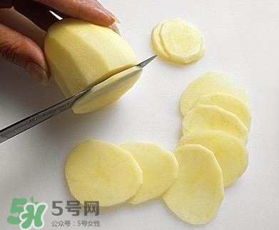 土豆片能去除痘印吗,土豆真的可以祛痘印吗 土豆片能去除痘印吗,土豆真的可以祛痘印吗