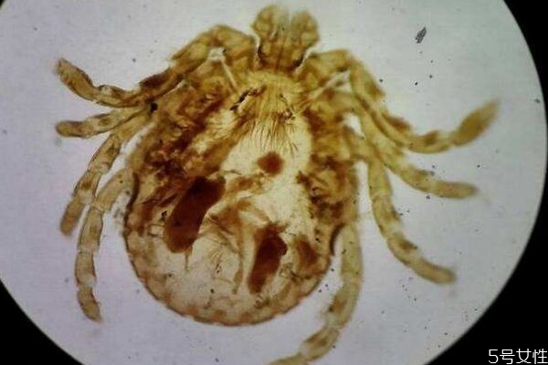 去除床上螨虫的办法有什么(如何除去床上的螨虫)