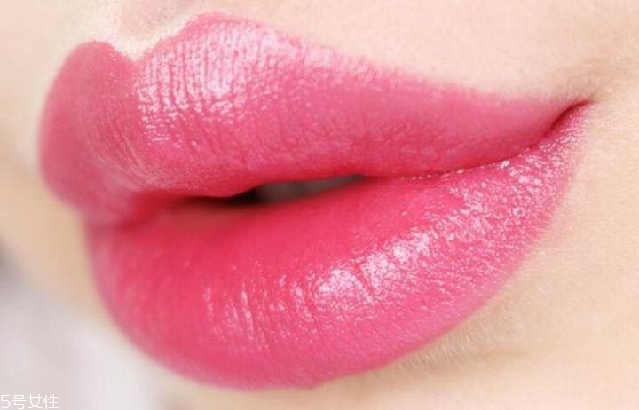 肾积水应该怎么预防呢(怎样预防肾积水)