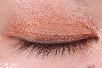 补充益生菌有什么注意的呢(补充益生菌有用吗)