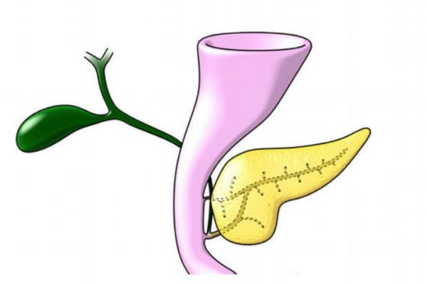 胰腺癌的主要症状是什么呢(胰腺癌都有哪些症状是什么)
