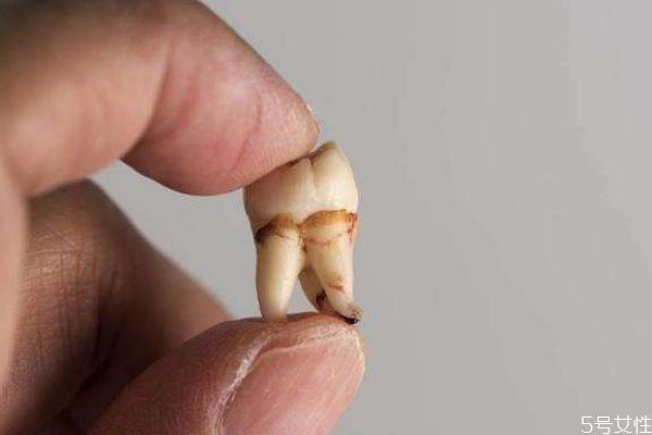 智齿的作用有什么呢(智齿的作用是什么) 智齿的作用有什么呢(智齿的作用是什么)