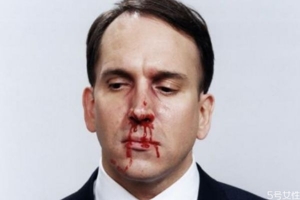 鼻子出血有什么注意的呢(鼻子出血应该注意什么)