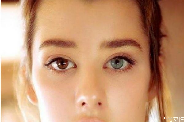 瞳孔异色症造成的原因是什么呢(瞳孔异色症怎么得)