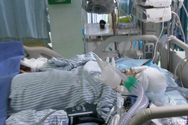 脑死亡的特征是什么呢(脑死亡的特点)