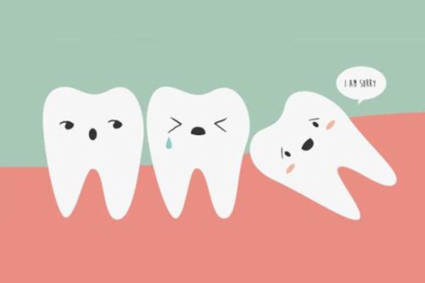 拔智齿后多久可以正常吃饭(拔智齿后多久可以正常吃饭包括硬的) 拔智齿后多久可以正常吃饭(拔智齿后多久可以正常吃饭包括硬的)