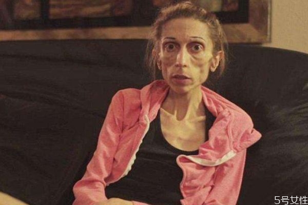 厌食症的形成原因有什么呢(厌食症是什么原因引起的)