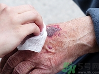 外伤吃啥食物好得快,有外伤吃什么好得快 外伤吃啥食物好得快,有外伤吃什么好得快