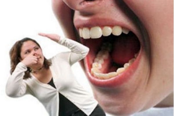 口臭是什么原因引起的(口臭是什么原因引起的,怎样去除) 口臭是什么原因引起的(口臭是什么原因引起的,怎样去除)