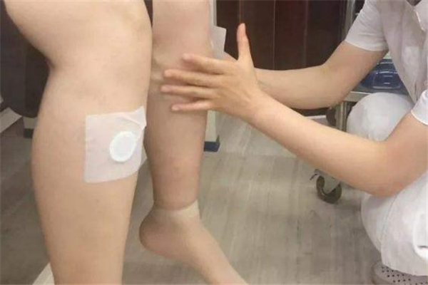 哪些人不能贴三伏贴(哪些人不能贴三伏贴) 哪些人不能贴三伏贴(哪些人不能贴三伏贴)