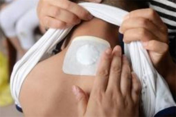 三伏贴一定要去医院吗(三伏贴一定要去医院吗)