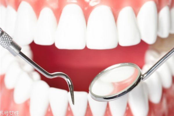 如何预防牙结石(如何预防牙结石和牙龈萎缩) 如何预防牙结石(如何预防牙结石和牙龈萎缩)