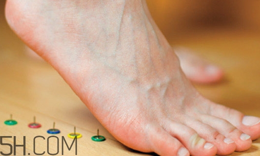 早上下床脚后跟疼是什么原因,早上起来下床脚疼是什么原因