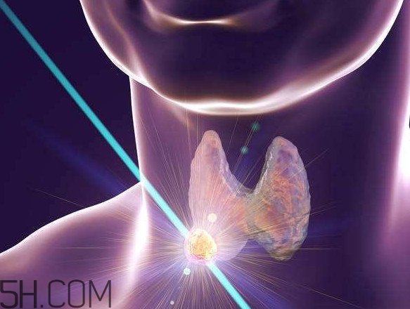 什么样的甲状腺结节要怀疑是癌?,甲状腺结节一定是癌吗?