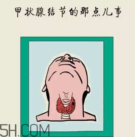 为什么会得甲状腺结节病,女人为什么会得甲状腺结节