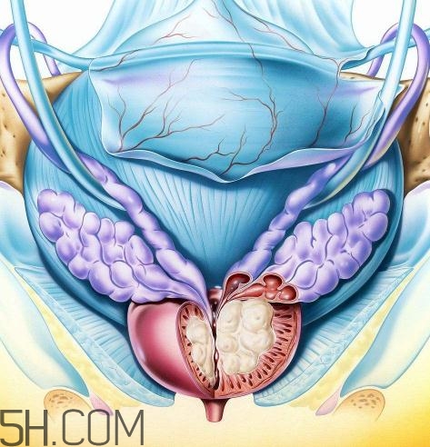 前列腺增生会不会癌变?,前列腺增生会癌变吗 前列腺增生会不会癌变?,前列腺增生会癌变吗