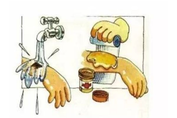 烫伤后怎么处理(烫伤后怎么处理好的最快)