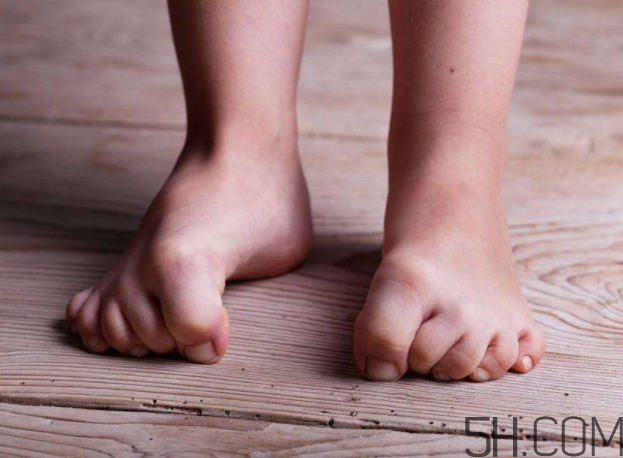 脚气会通过床单传染吗?,脚气会通过床单传染到身上吗